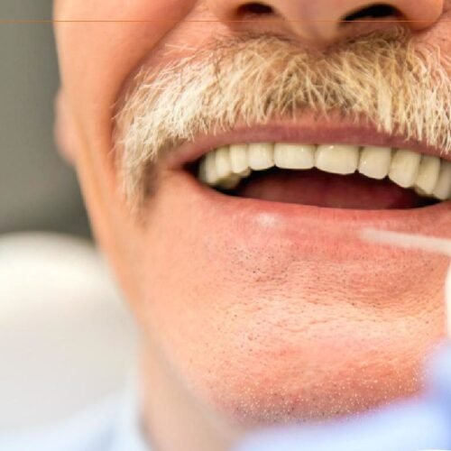 Tratamento odontologico