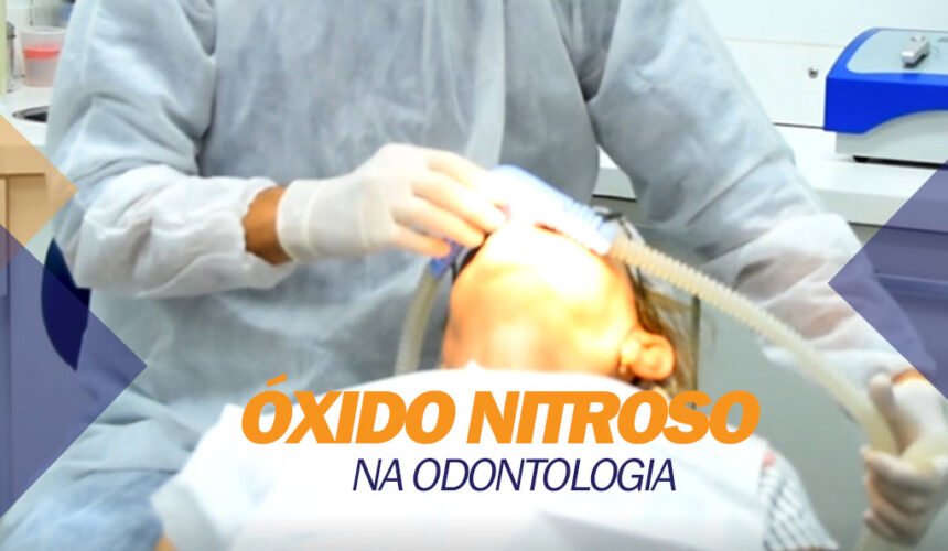 oxido-nitroso Óxido Nitroso na Odontologia