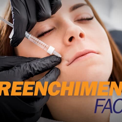 preenchimento-facial Preenchimento Facial