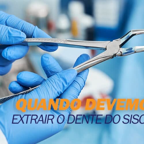 extrair-siso Quando devemos extrair o dente do siso?