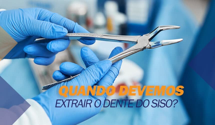 extrair-siso Quando devemos extrair o dente do siso?
