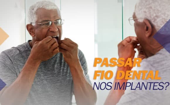 passar-fio-dental-no-implante Preciso usar FIO DENTAL no IMPLANTE dentário?