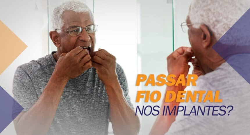 Preciso usar FIO DENTAL no IMPLANTE dentário?